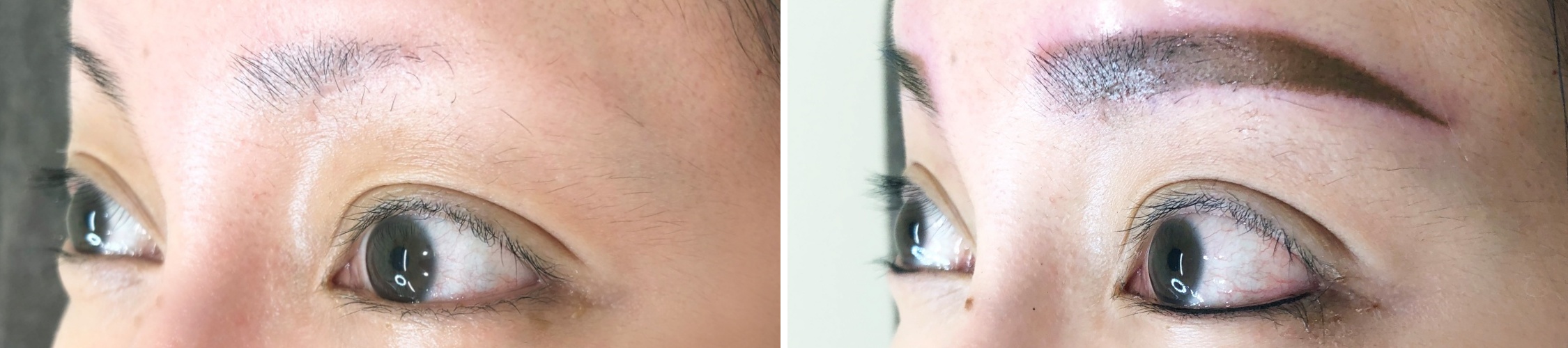 TACメディカルアートメイク（眉・アイライン・リップ）の症例写真 施術前後 直後