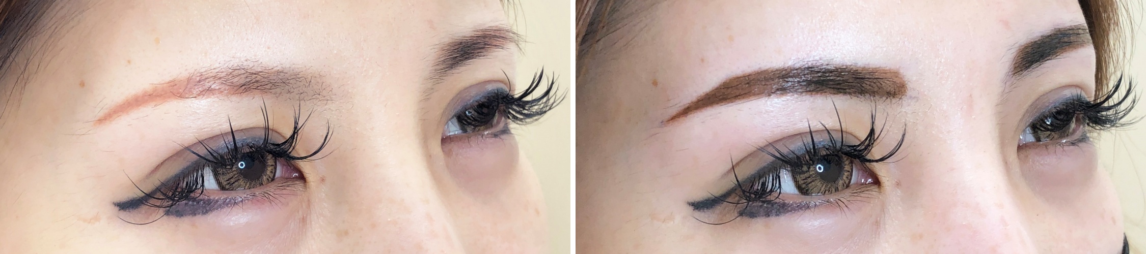 TACメディカルアートメイク（眉・アイライン・リップ）の症例写真 施術前後 直後