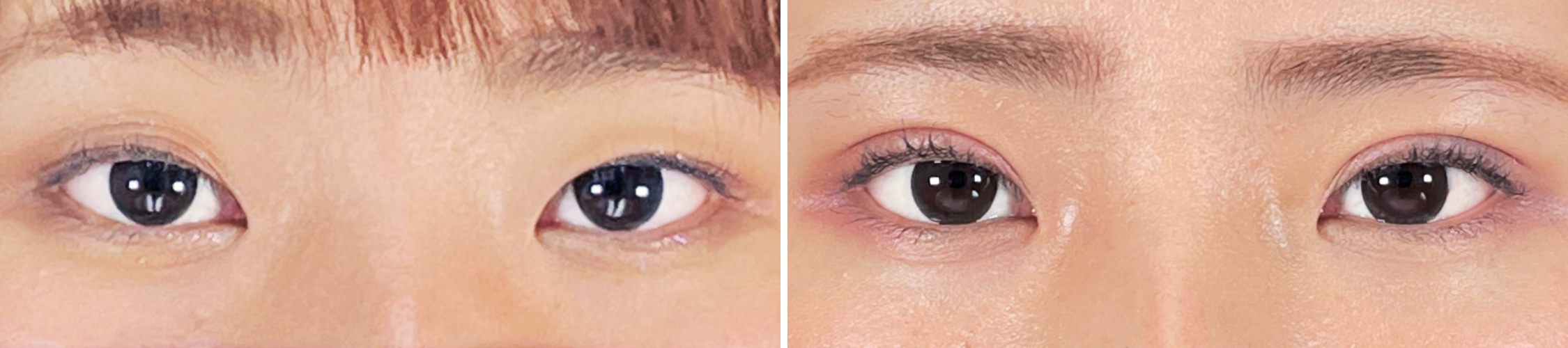 Dr.奥津のセンスで目の魅力が増す