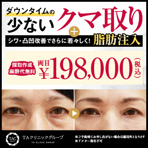 下眼瞼脱脂（目の下のクマ・ふくらみとり）＋脂肪注入モニター募集