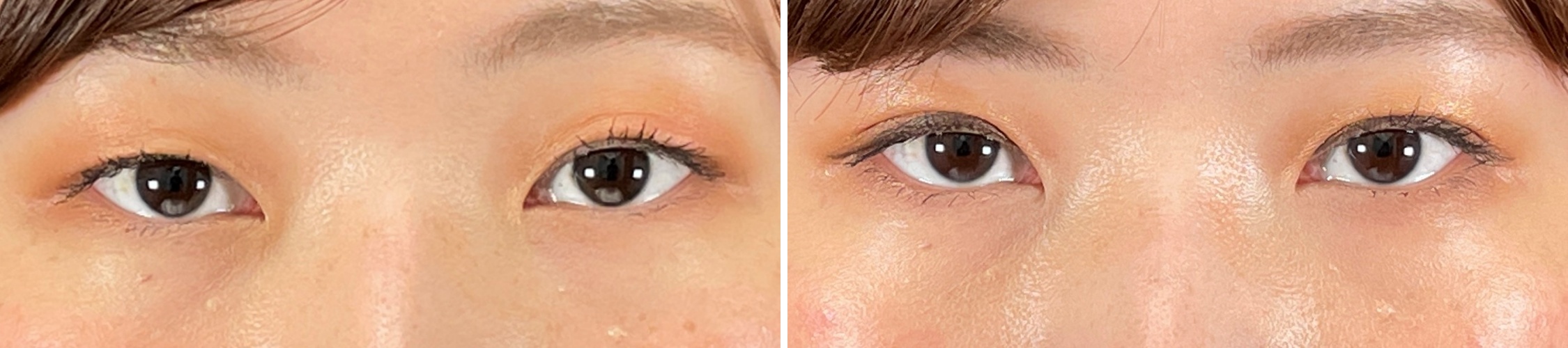 二重埋没法で目力アップ