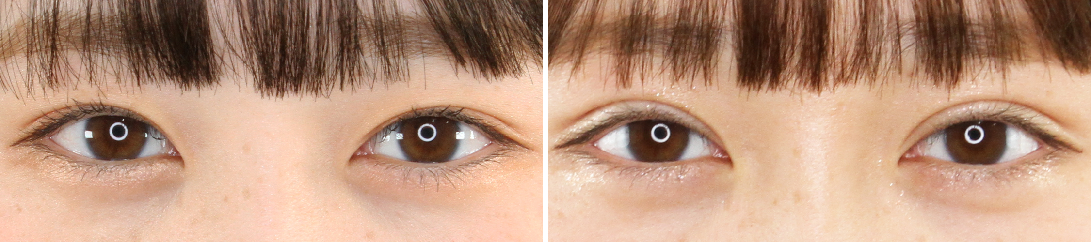 幅を広げてより可愛らしいお目元に