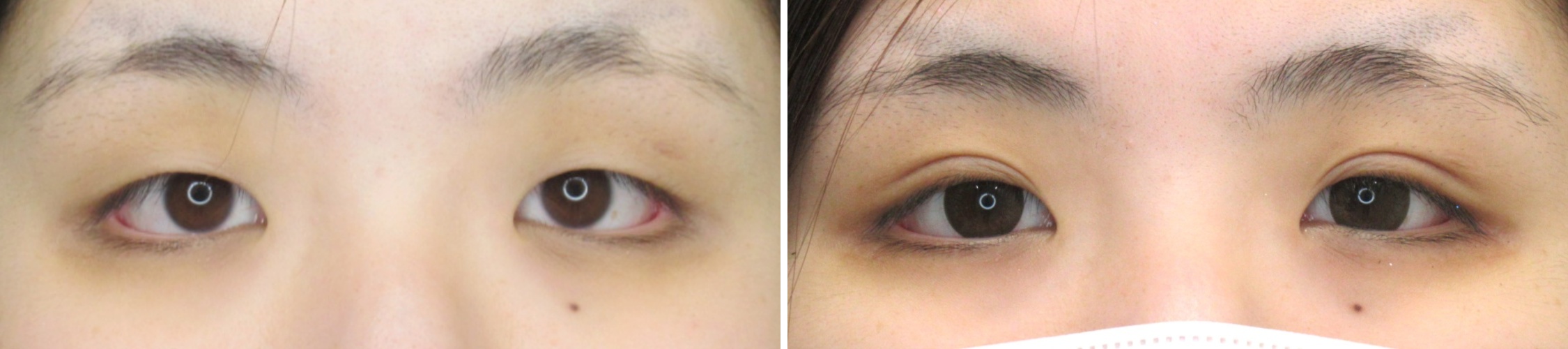 より自然な仕上がりが希望ならコスメリング