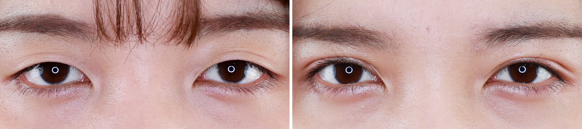 埋没法で幅狭ナチュラルふたえラインでもガッツリ目力