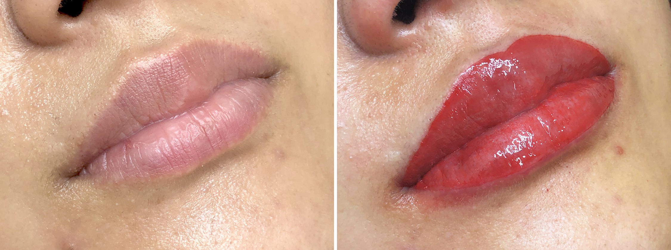 TACメディカルアートメイク（眉・アイライン・リップ）の症例写真 施術前後 直後