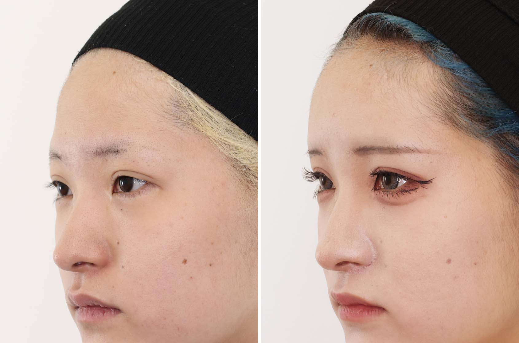 憧れのあのひとの形のいいおでこ。