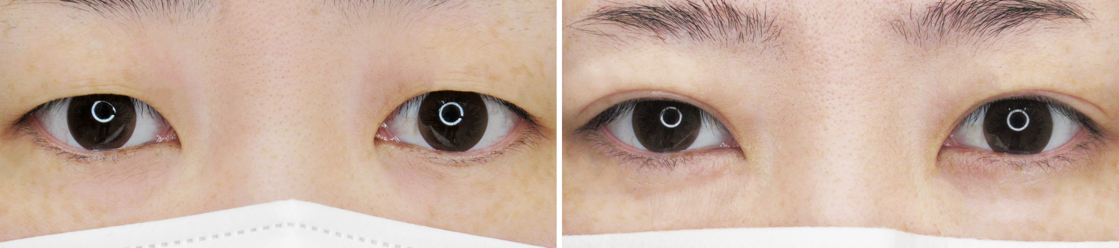 クイックコスメリングで理想の目元に