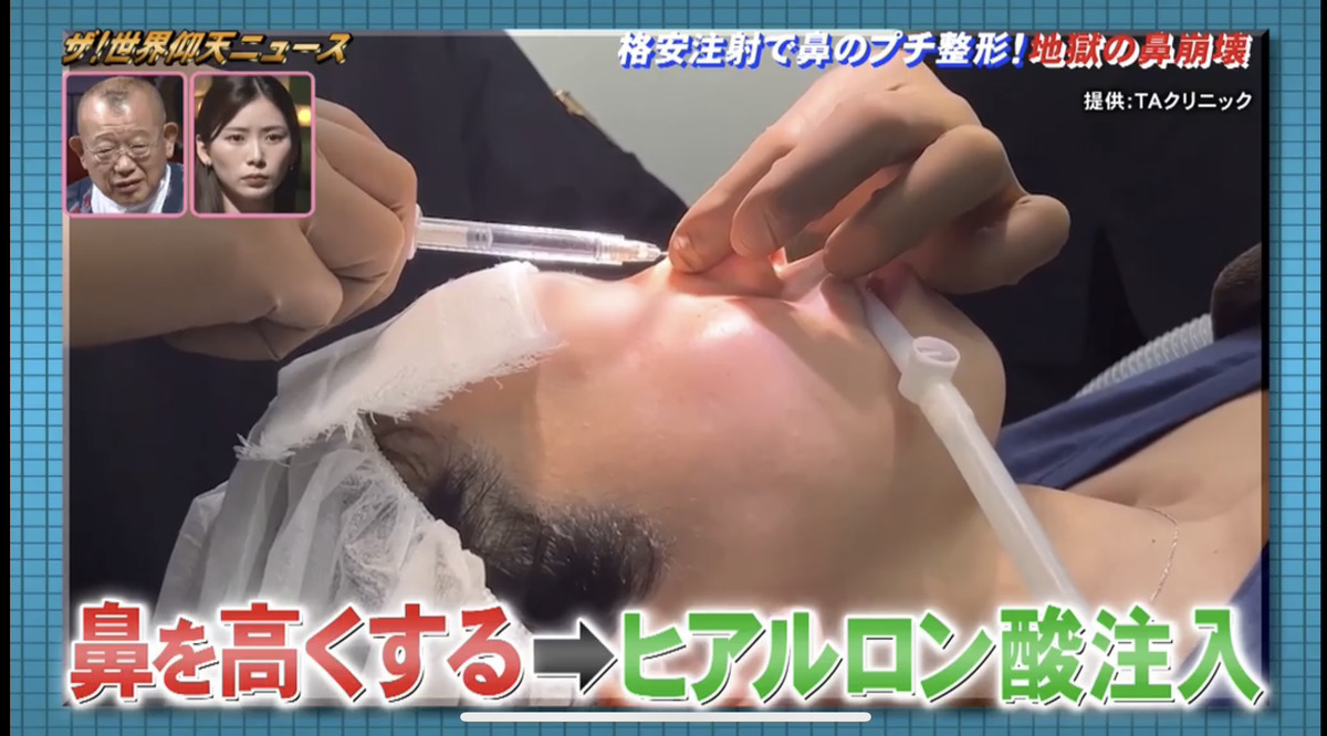 TV:ザ!世界仰天ニュース