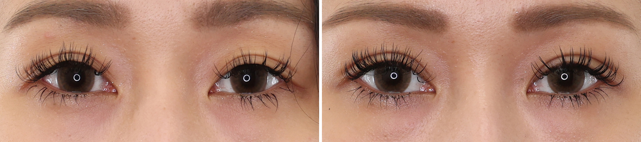 安定しなかった❝二重ライン❞を改善