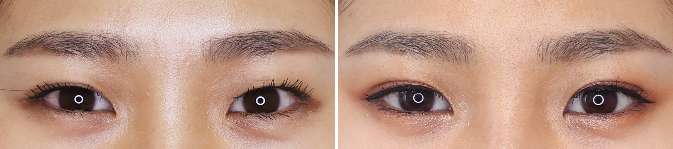 自然な末広二重で目元が華やかに変化！