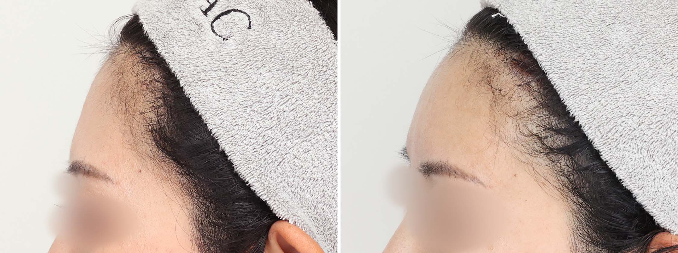 憧れだった大人なオルチャンデコへ