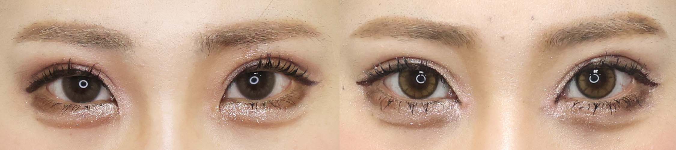 目頭切開術でナチュラルに目力UP