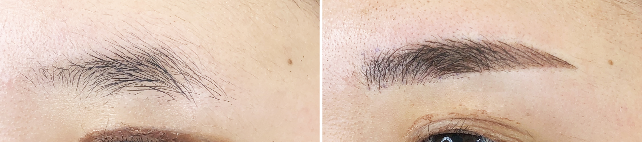 TACメディカルアートメイク（眉・アイライン・リップ）の症例写真 施術前後 直後