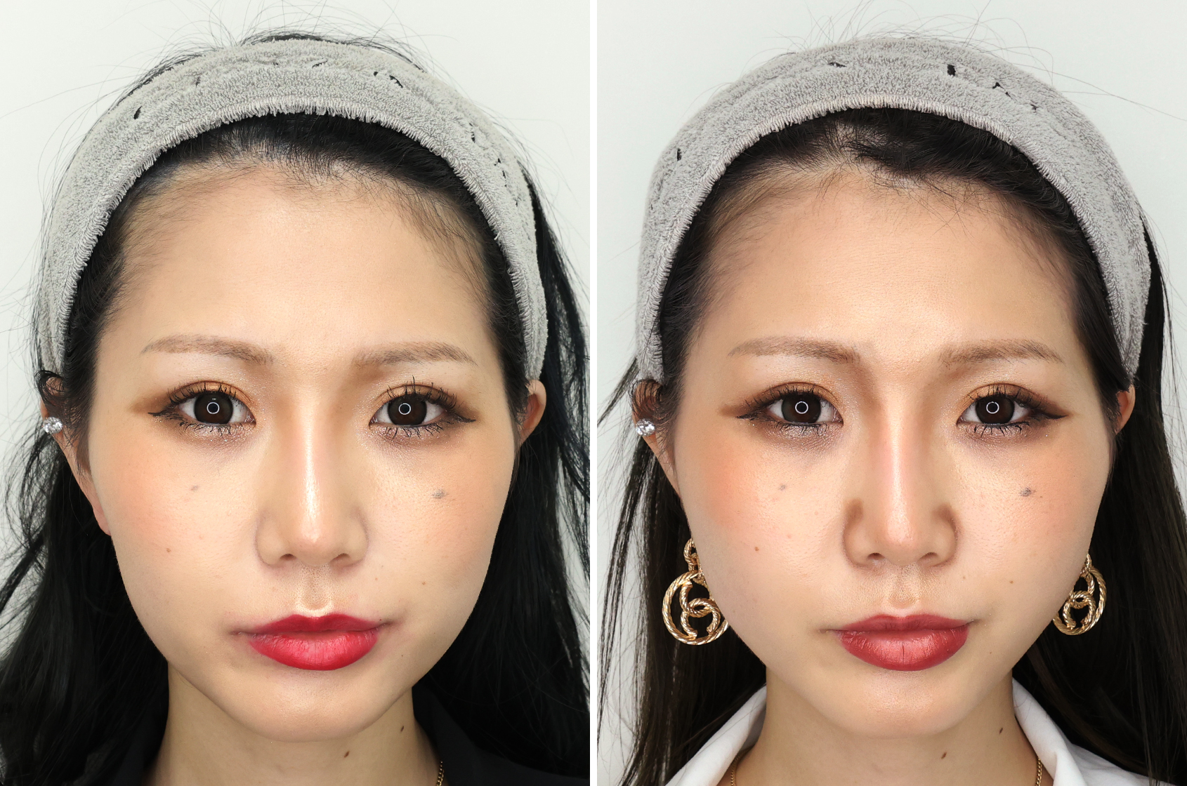 正面、横顔全てが美しいフェイスライン