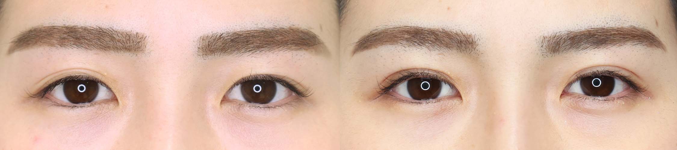 マスク生活で重要な目の印象変えませんか？【1dayナチュラルデザイン】