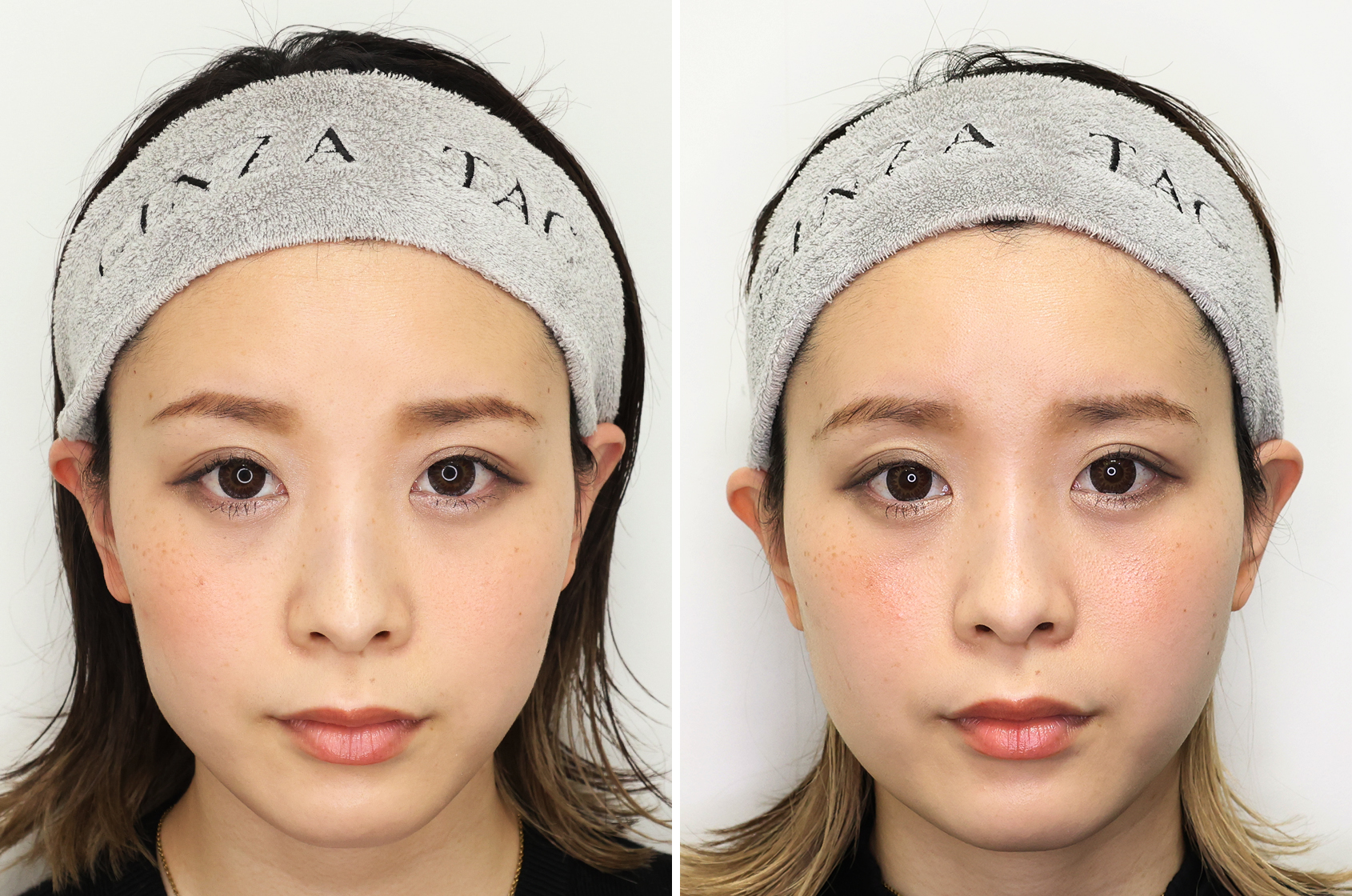 可愛い＋綺麗を兼ね備えた卵型フェイスライン