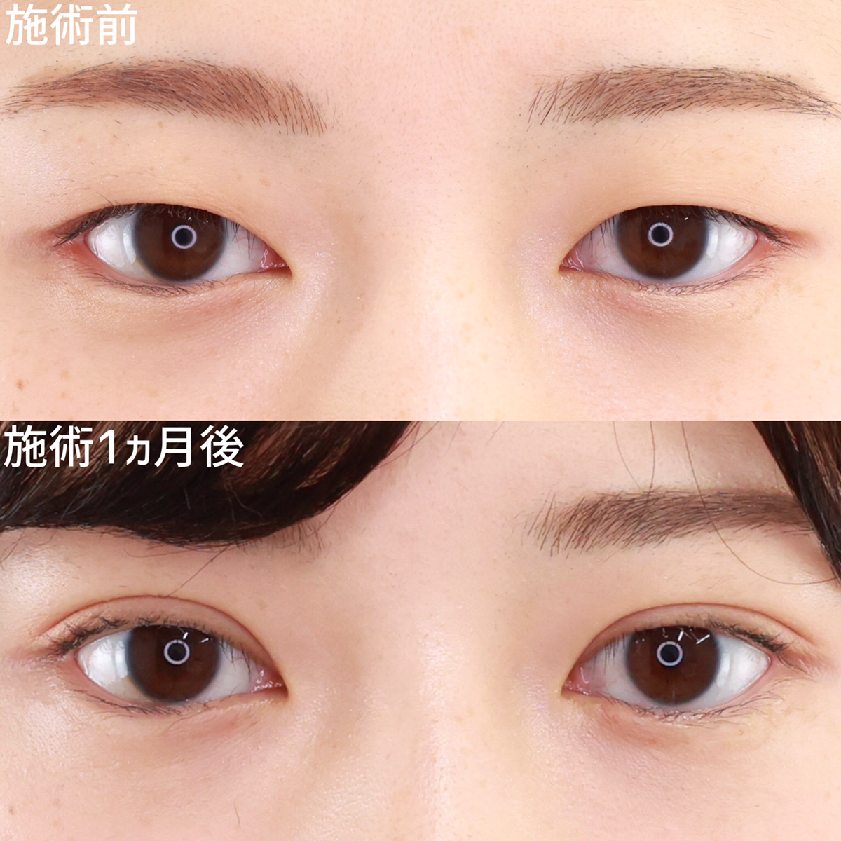 二重埋没法で自分に合った華やかeyeに
