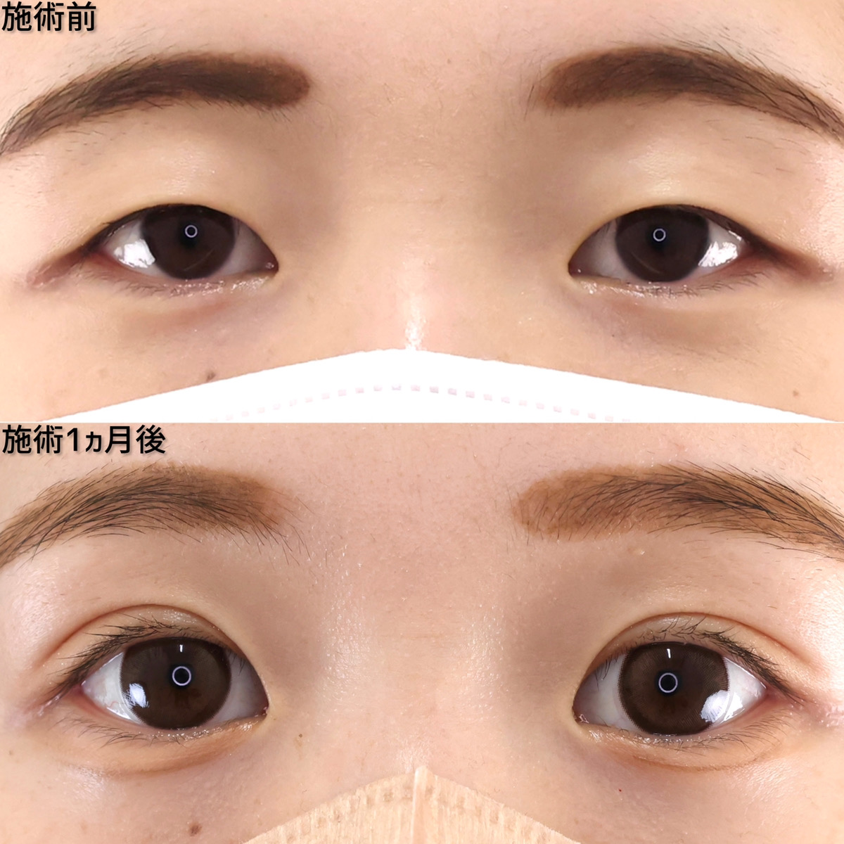 【二重埋没法】でつくる！末広型の愛されお目元。