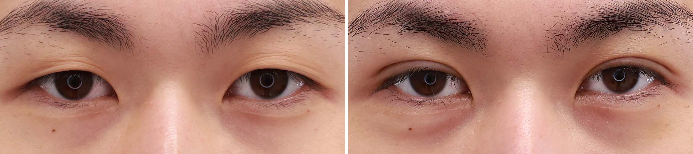 『目は口ほどにものをいう』目力◎なメンズ末広二重。