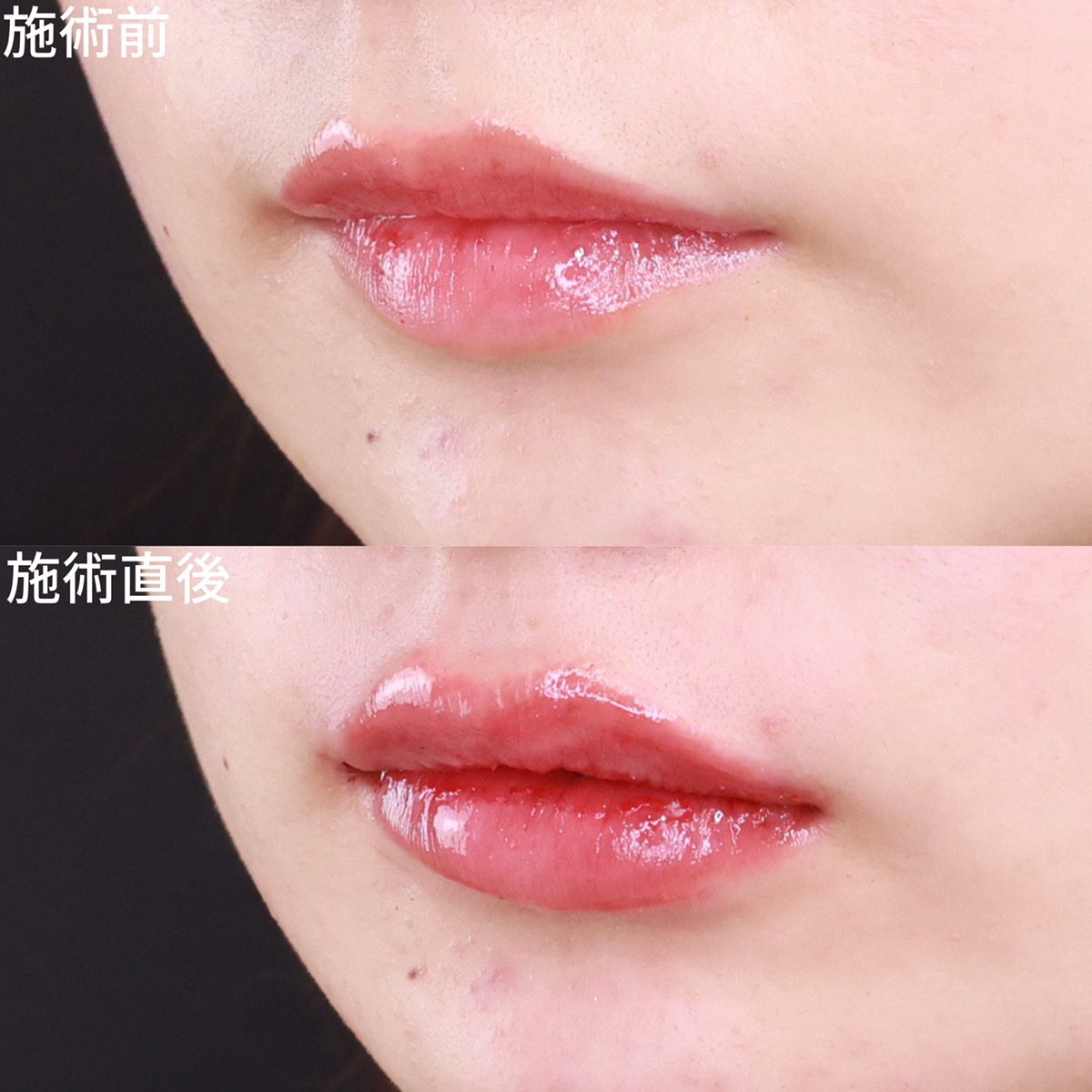 メリハリのあるセクシーリップ