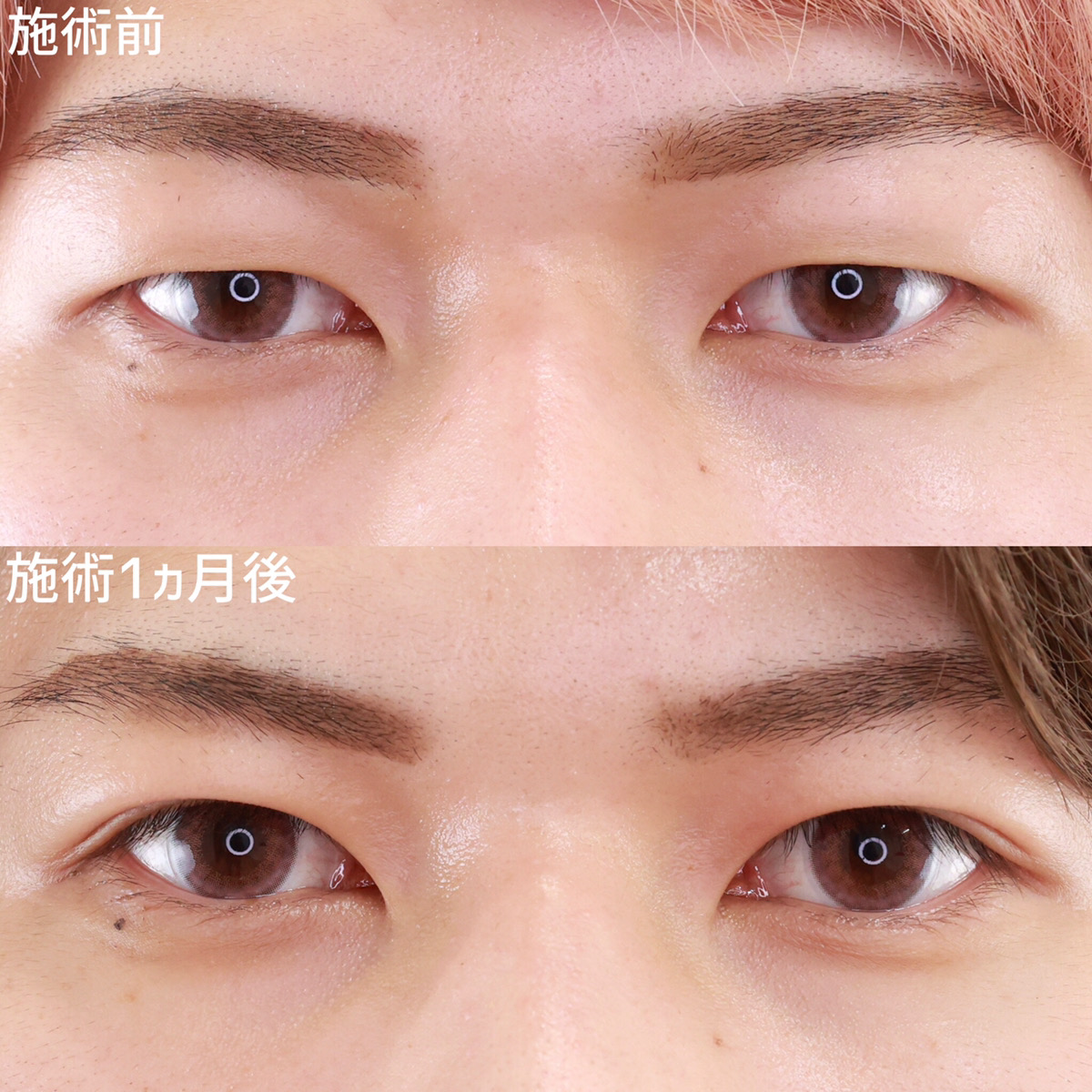 キリっとさわやかイケメン！メンズ二重急増中！