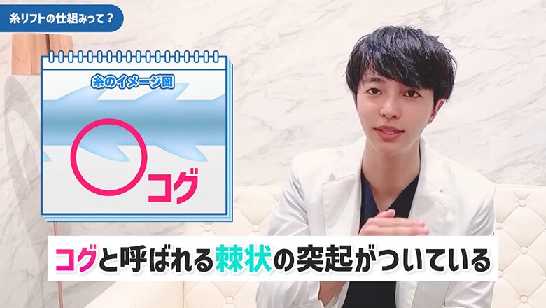 糸リフトのコグ