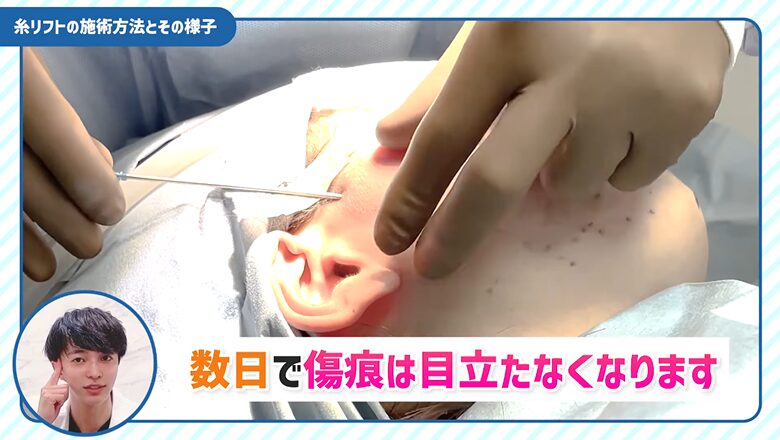 傷跡は目立たない