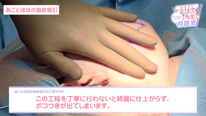 仕上がりがボコつかないよう丁寧に処理を進める様子