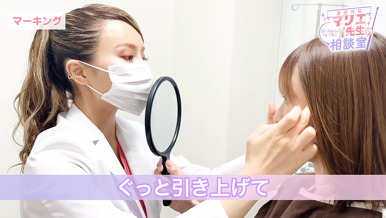 天使もえさんのこめかみを手で引き上げて方向を示すマリエ医師