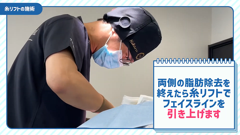 脂肪除去を終えて糸リフトの施術に移る森医師