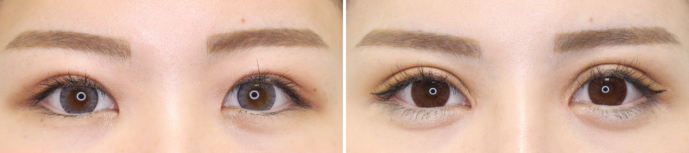 症例写真 ビフォーアフター ダウンタイム 副作用 目元切開術 憧れの大きな可愛い目元に Taクリニックグループ 美容整形 美容外科 全国展開中