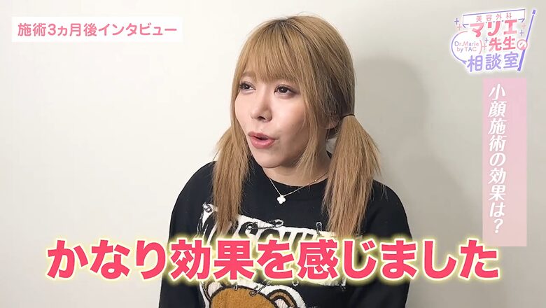 小顔施術の効果をかなり感じたと語る芹野莉奈さんのインタビュー