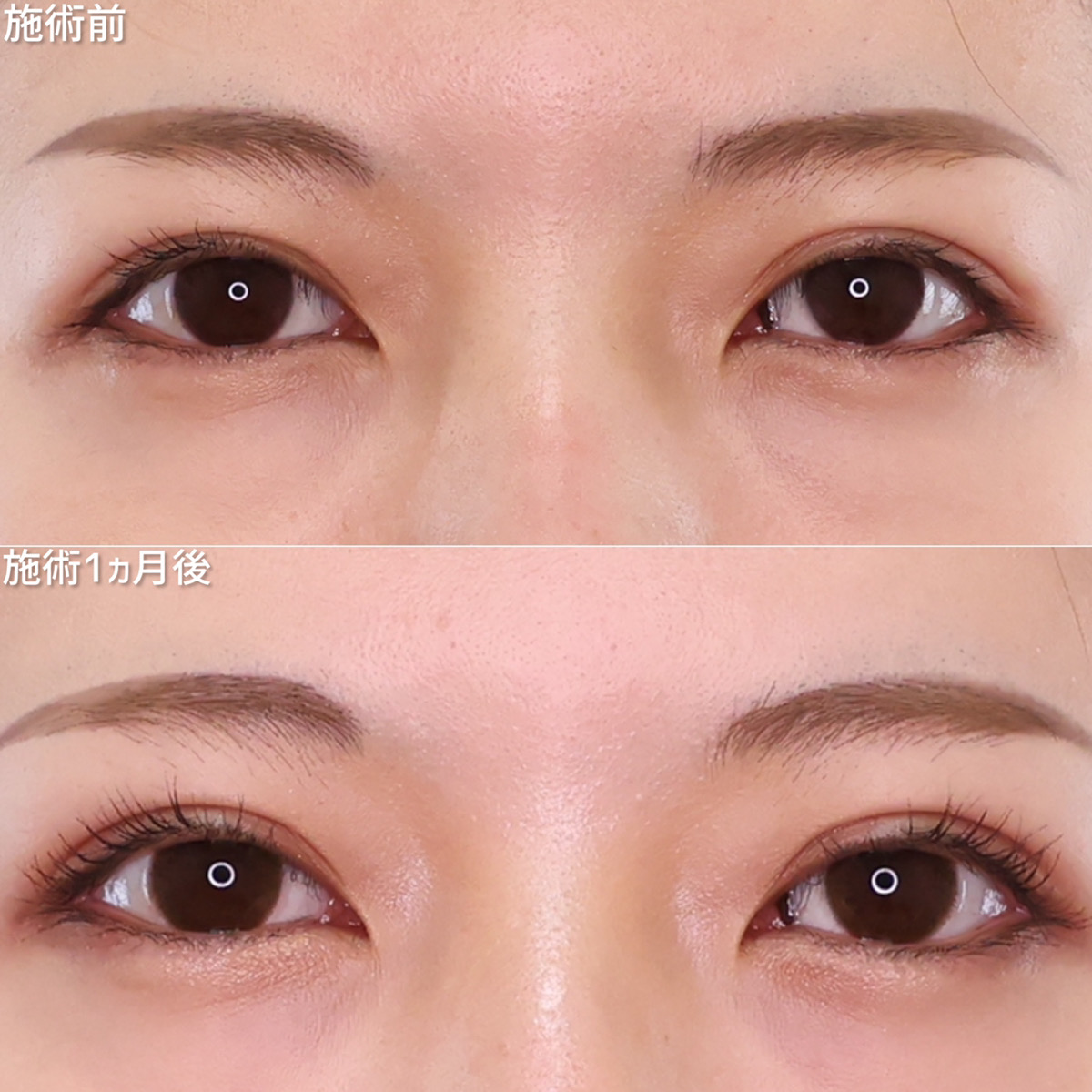 ミリ単位の変化で華やかさup！