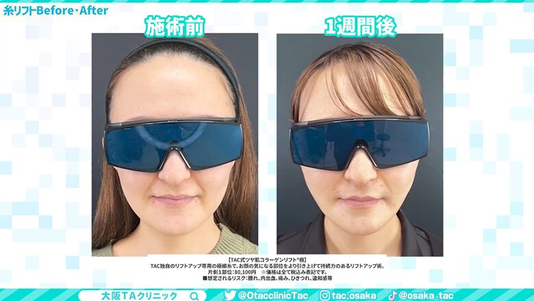 施術前後の変化