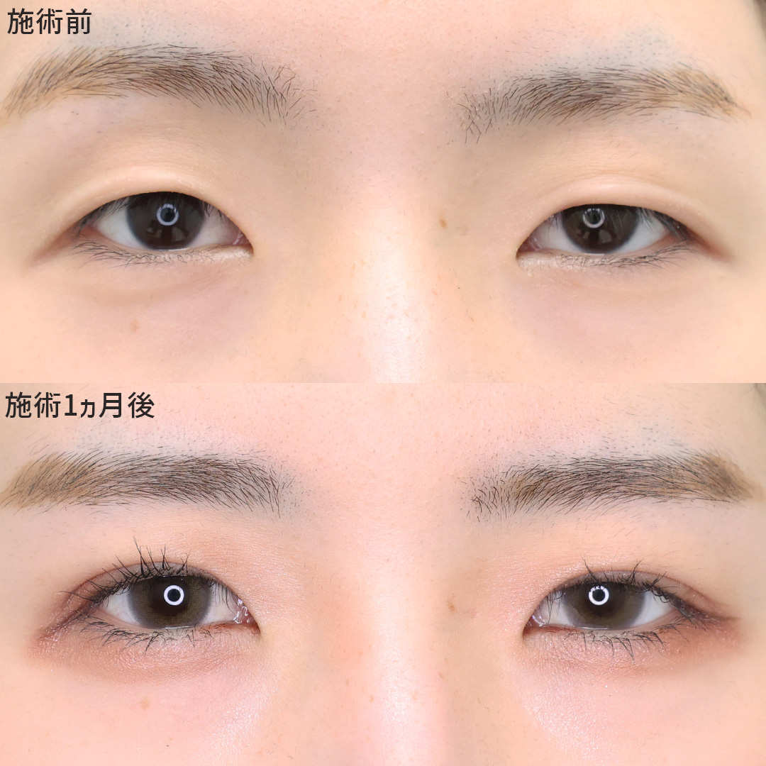 【埋没法】でナチュラルにイメージチェンジ