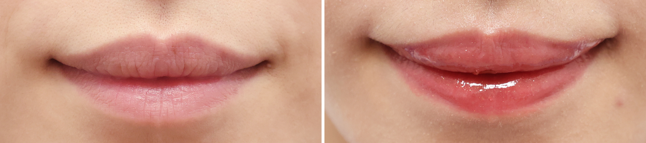 華やかな口元は【口角挙上】で。明るい印象になって好感度アップ！！