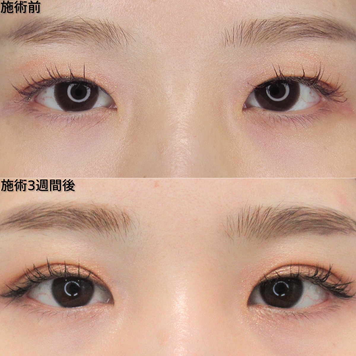 コスメリングで自分好みの二重を手に入れる