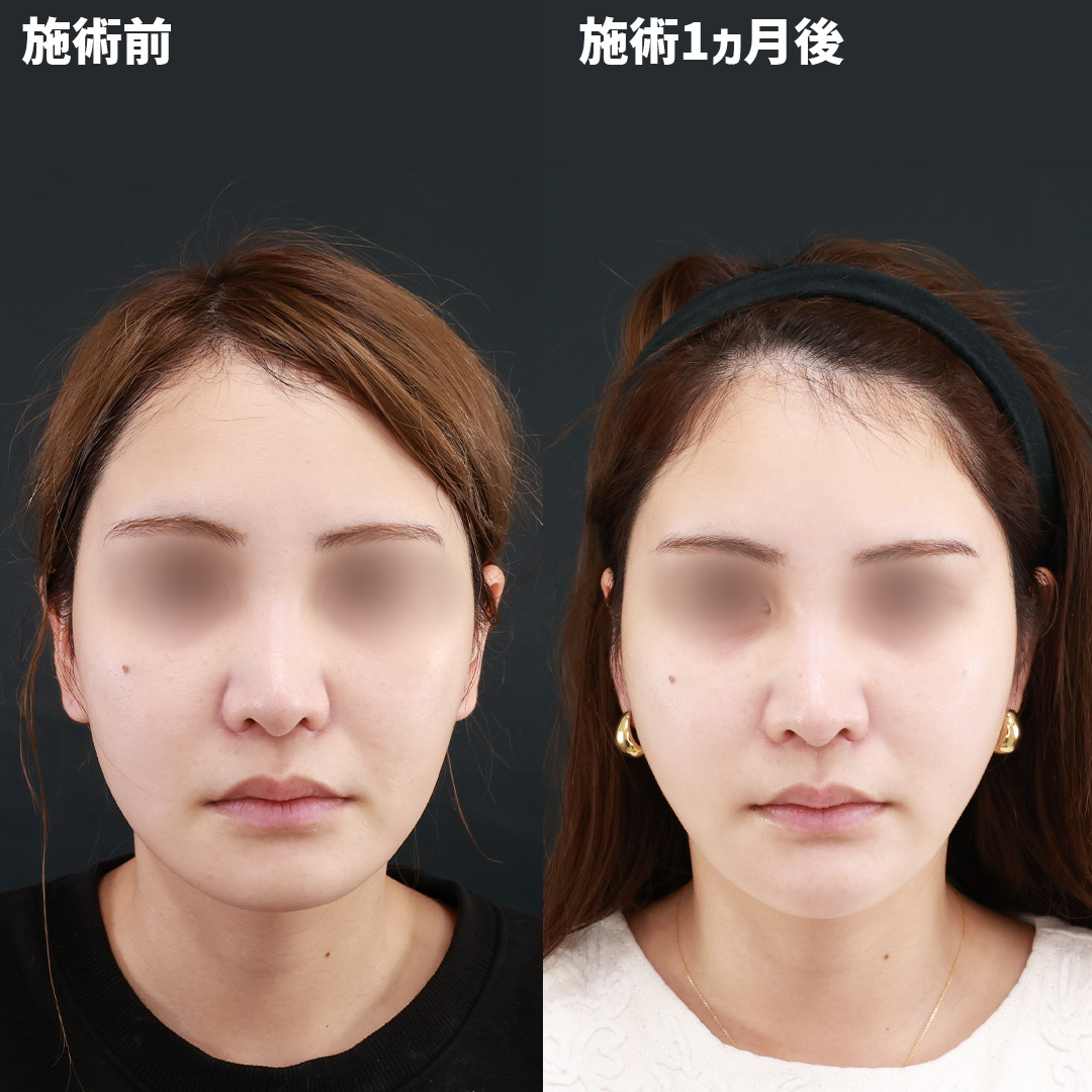 【卵型輪郭】30代から始めるフェイスケア