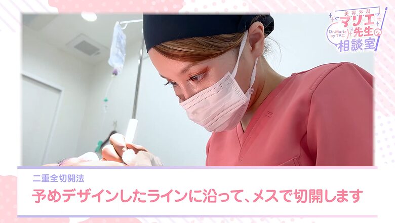 二重全切開法の手術開始、デザインラインに沿ってメスで切開