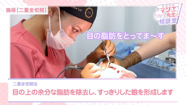 目の上の余分な眼窩脂肪を除去し、すっきりした幅広二重を形成