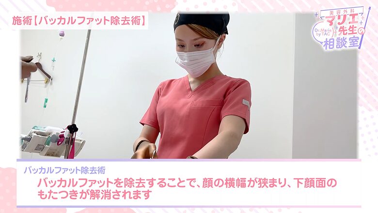 下顔面のもたつきを解消するバッカルファット除去術