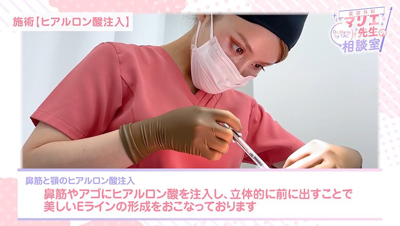 美しいEラインを形成するため鼻筋と顎にヒアルロン酸を注入