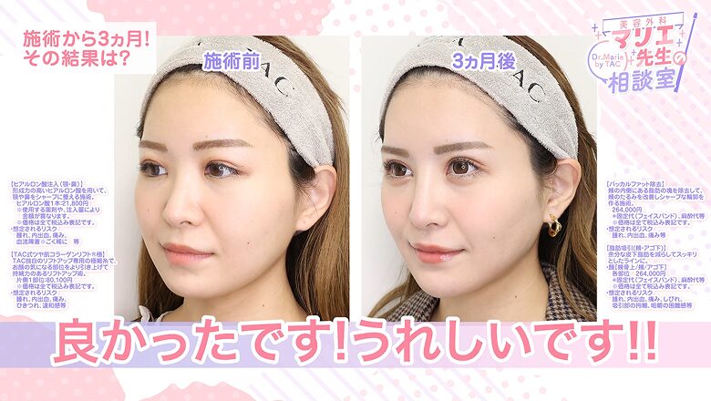 斜めからの比較写真