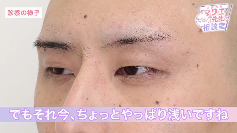 ソリン・マルコフ様の目元を診察するマリエ医師