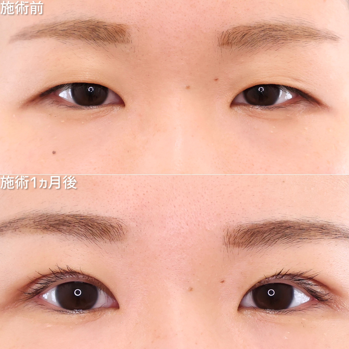 食い込みしっかり！ぱっちり末広型二重