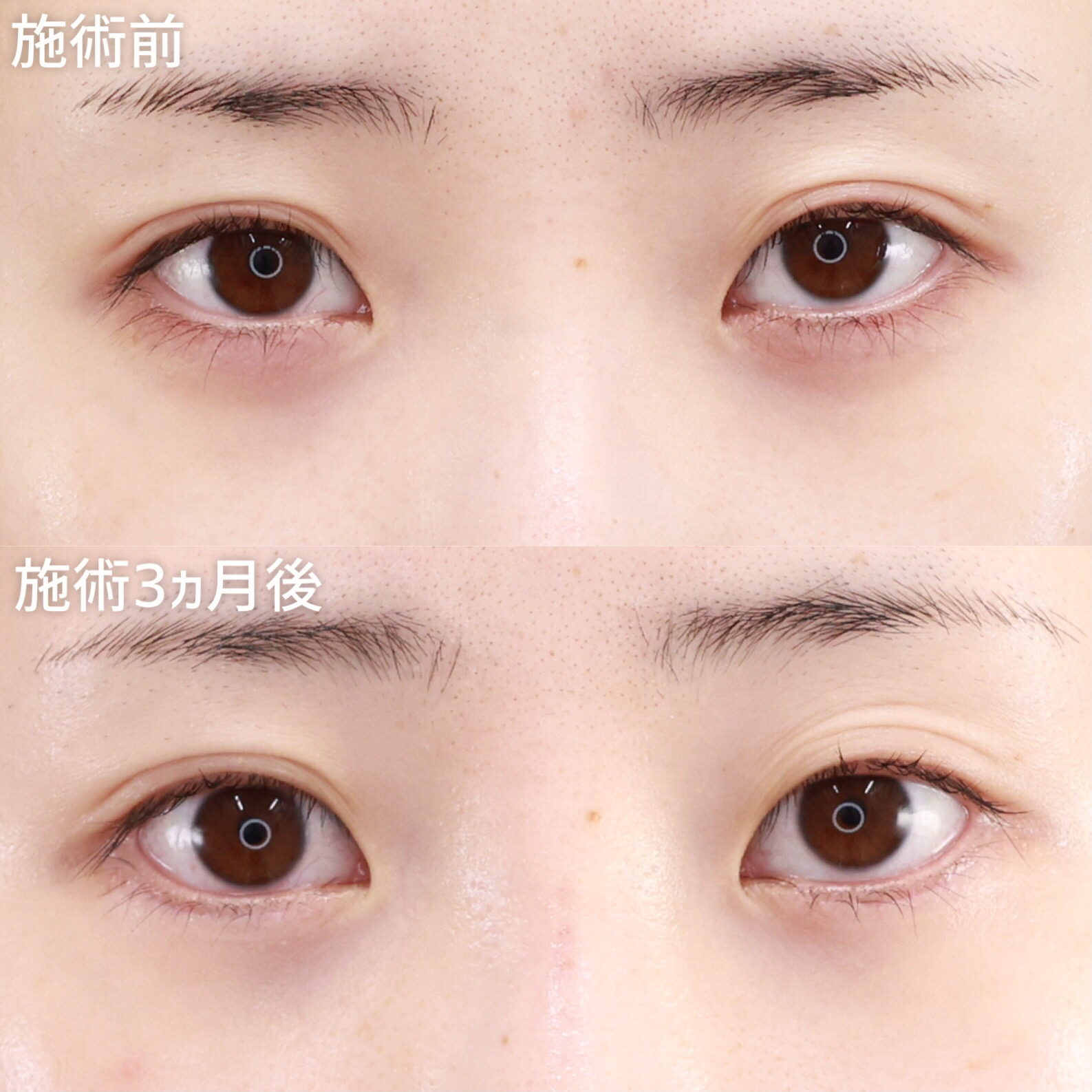 【グラマラスライン】つり目を軽減！目を下方向に広げて大きく！