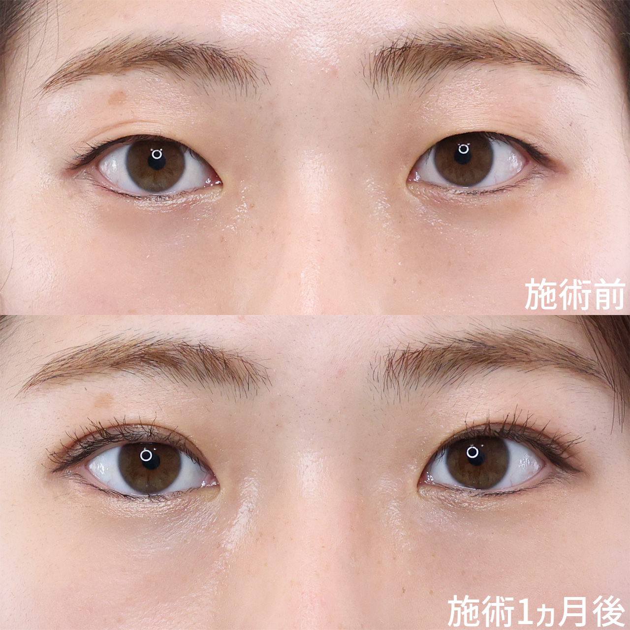 【二重埋没】毎日のメイクに革命を！