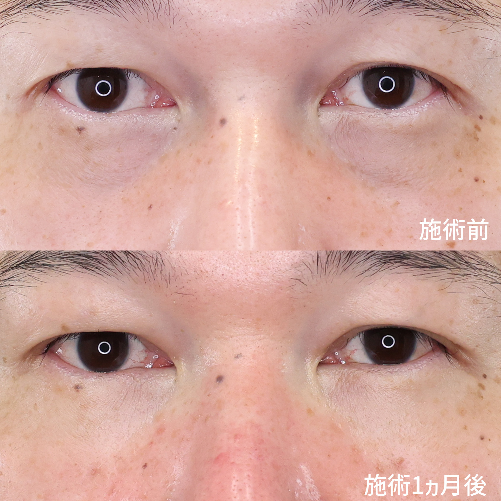 目元から変える！40代男性のエイジングケア。