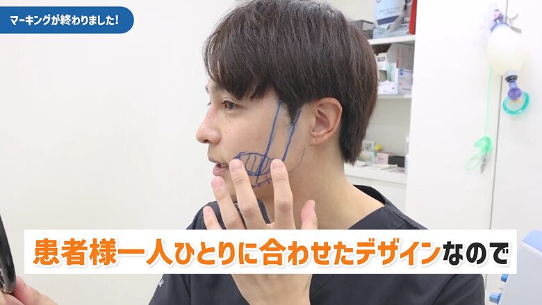患者様の骨格や状態に合わせたデザインの解説