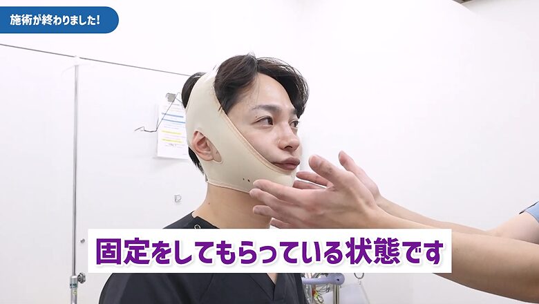 ジョールファット除去直後、フェイスバンドで固定中の様子
